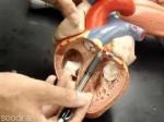 مولاژ تخصصی قلب -pic1