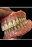 دندانسازی تجربی عسگری-pic1