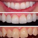 دندانپزشکی مروارید اصفهان،ارائه بهترین خ-pic1
