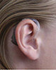 شرکت تجهیزات شنوایی ثمین آوا-pic1