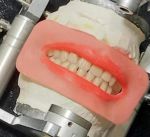 ساخت دندان مصنوعی طبیعی