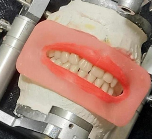 ساخت دندان مصنوعی طبیعی-pic1