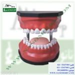 مولاژ دندان با قابلیت جدا شدن دندانها-pic1
