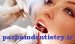خدمات دندانپزشکی-مناسب ترين رنگ لامينينت