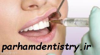 پوسیدگی دندان - دندانپزشکی-pic1